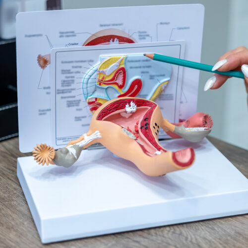 Modele anatomiczne nadciśnienia tętniczego jako niezastąpione wsparcie w edukacji i zwalczaniu chorób cywilizacyjnych